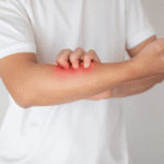The Mind-Skin Connection Can Stress Cause Dry, Itchy Skin