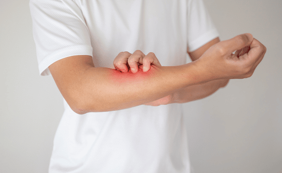 The Mind-Skin Connection Can Stress Cause Dry, Itchy Skin