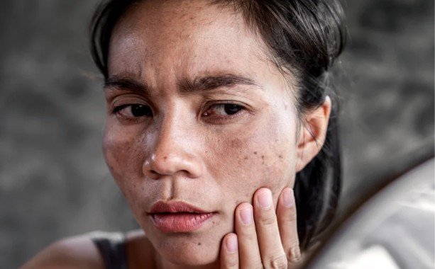 How to Protect Your Skin Daily